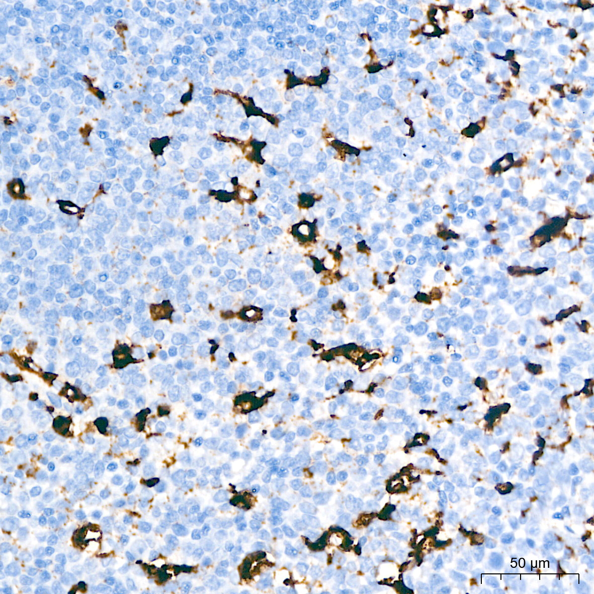CD68 Rabbit Monoclonal Antibody - Image 4