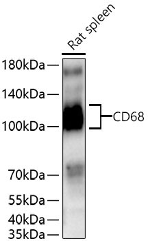 CD68 Rabbit Polyclonal Antibody - Image 4