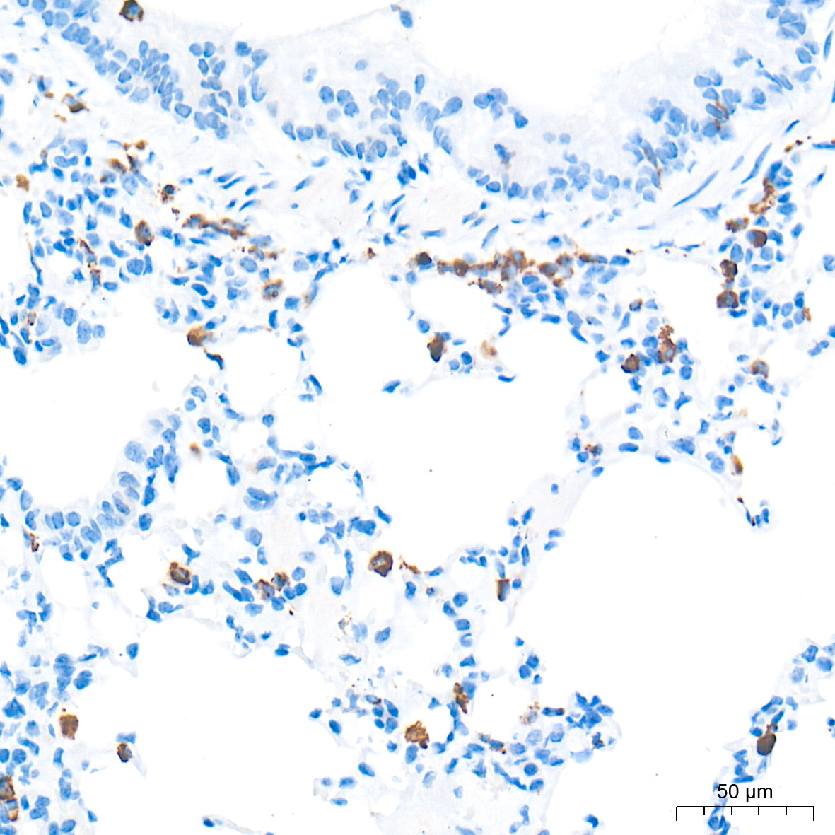 CD68 Rabbit Polyclonal Antibody - Image 5