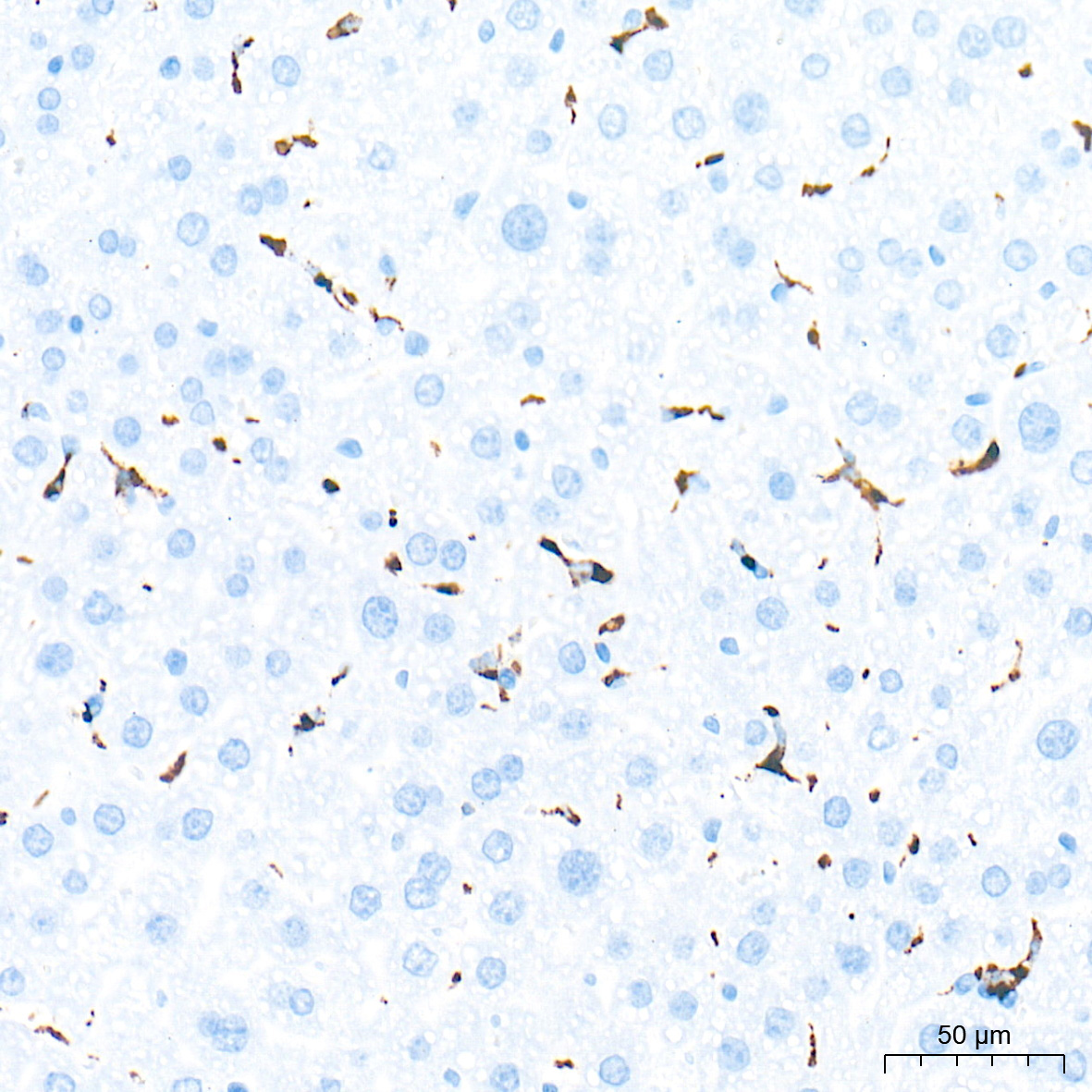 CD68 Rabbit Polyclonal Antibody - Image 6