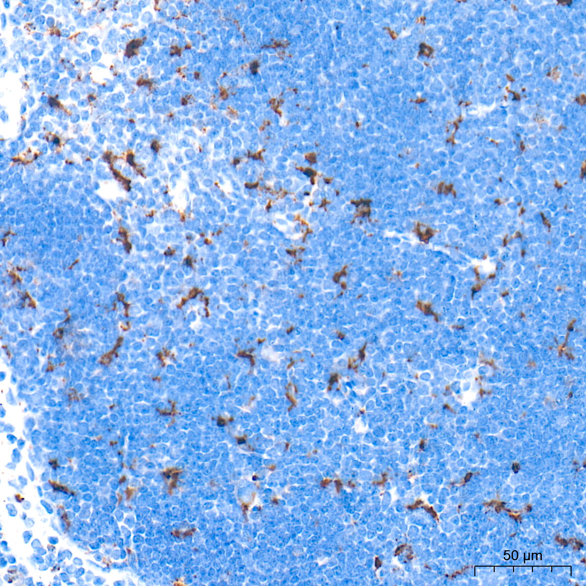 CD68 Rabbit Polyclonal Antibody - Image 7
