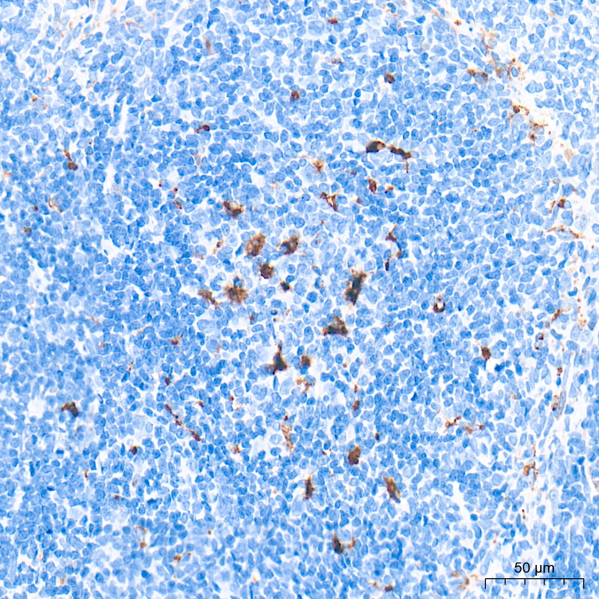 CD68 Rabbit Polyclonal Antibody - Image 8