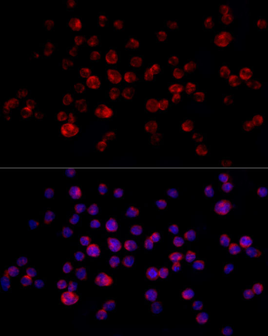 CD68 Rabbit Polyclonal Antibody - Image 10