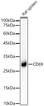 CD69 Rabbit Monoclonal Antibody