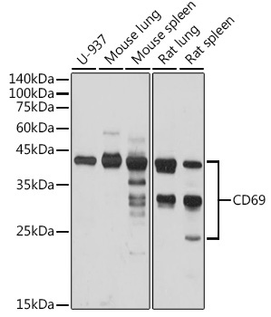CD69 Rabbit Polyclonal Antibody