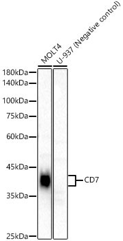 CD7 Rabbit Monoclonal Antibody