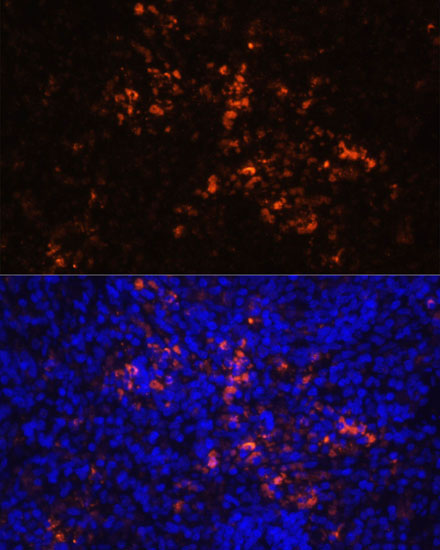 CD70 Rabbit Polyclonal Antibody