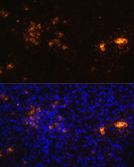 CD70 Rabbit Polyclonal Antibody