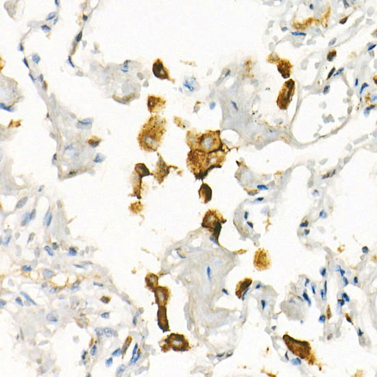 CD71/Transferrin Receptor Rabbit Monoclonal Antibody - Image 2