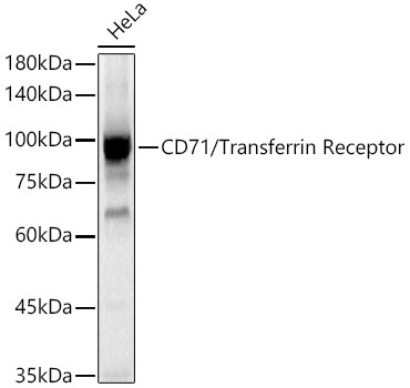 CD71/Transferrin Receptor Rabbit Polyclonal Antibody
