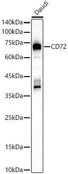 CD72 Rabbit Polyclonal Antibody