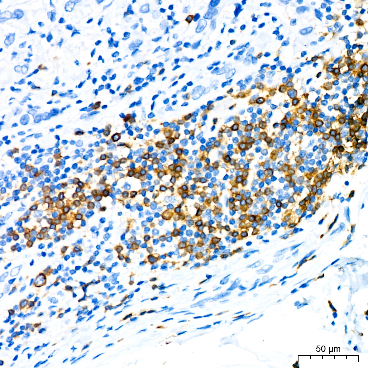 CD79a Rabbit Monoclonal Antibody - Image 2