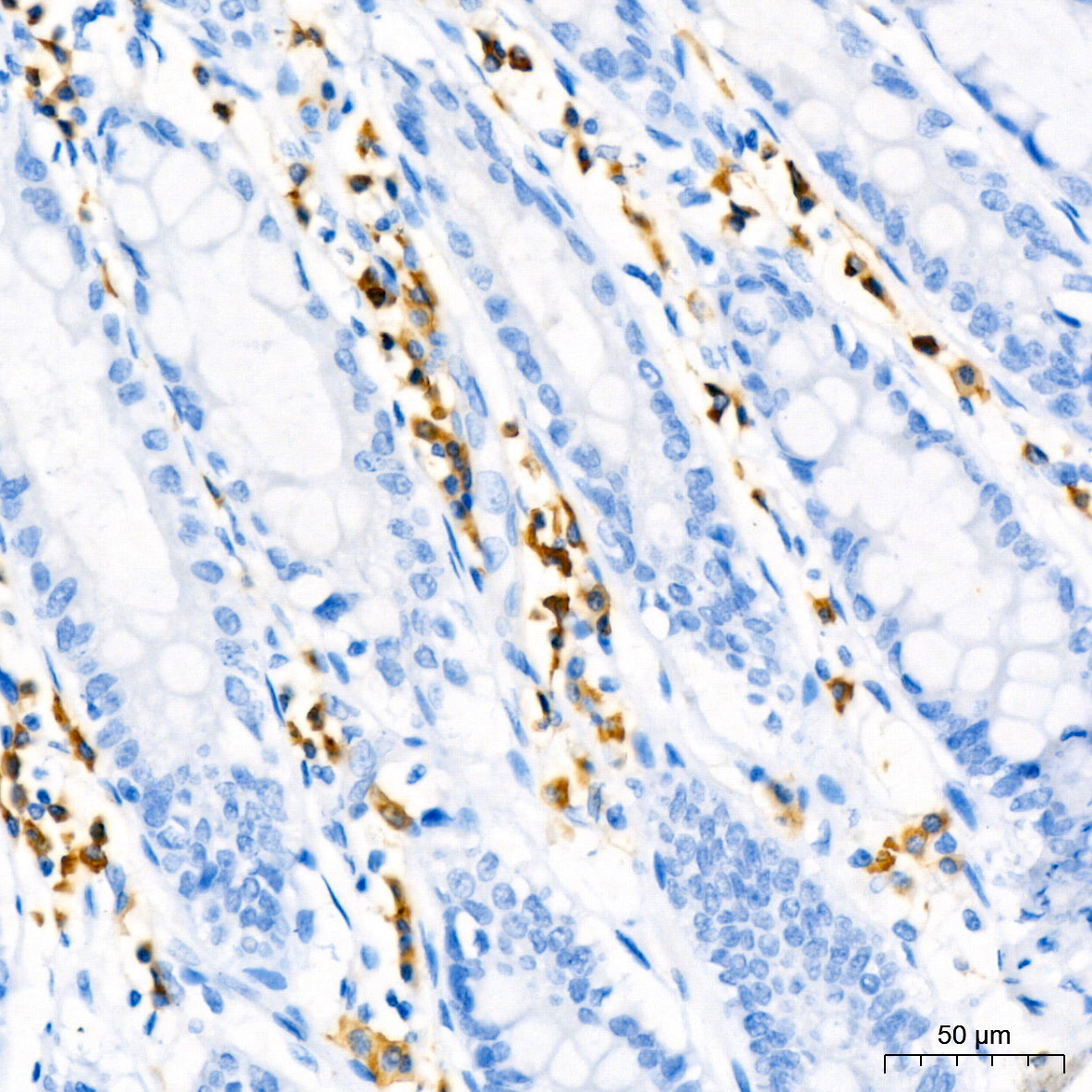 CD79a Rabbit Monoclonal Antibody - Image 3