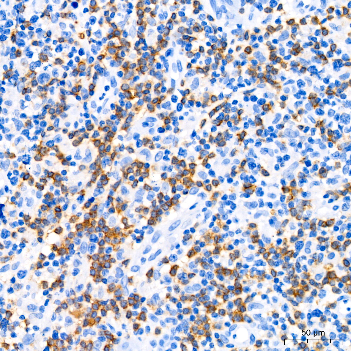 CD79a Rabbit Monoclonal Antibody - Image 4