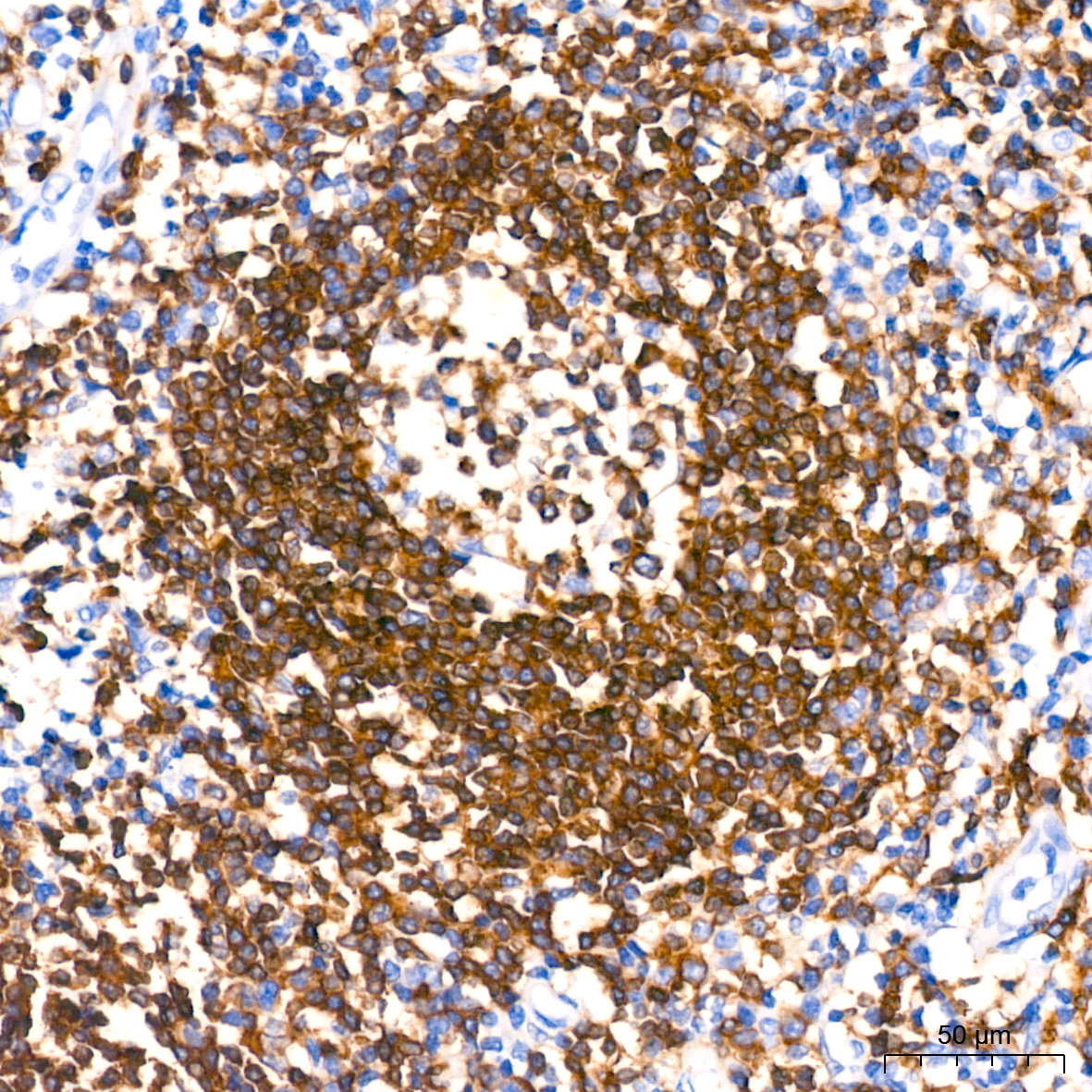 CD79a Rabbit Monoclonal Antibody - Image 5