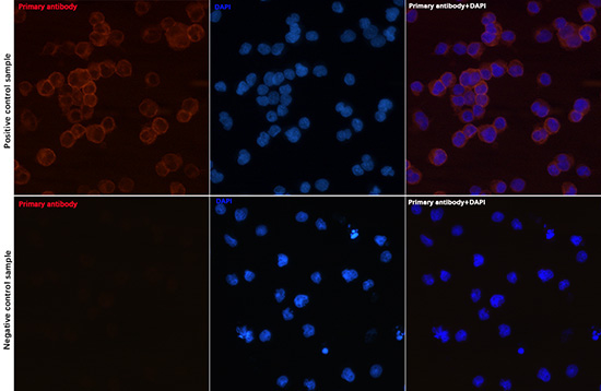 CD79a Rabbit Monoclonal Antibody - Image 6