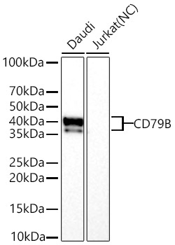 CD79B Rabbit Monoclonal Antibody