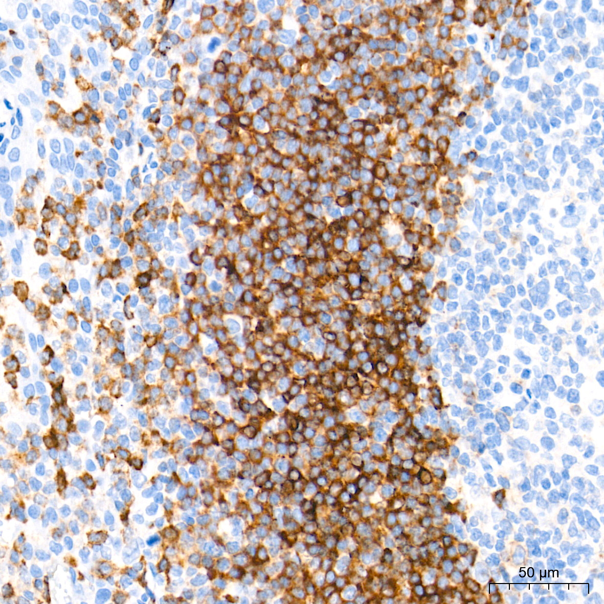 CD79B Rabbit Monoclonal Antibody - Image 2
