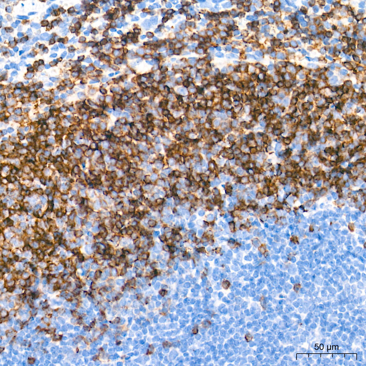 CD79B Rabbit Monoclonal Antibody - Image 3