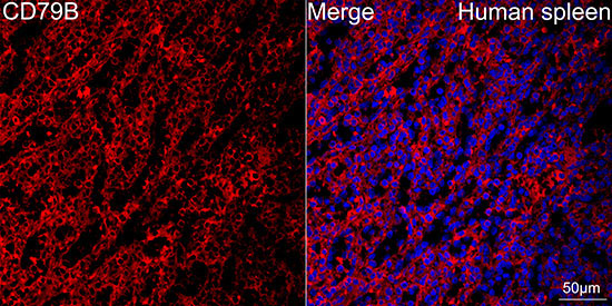 CD79B Rabbit Monoclonal Antibody - Image 4