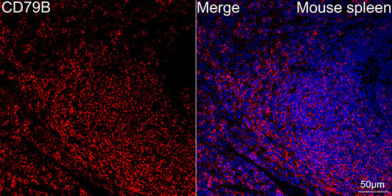 CD79B Rabbit Monoclonal Antibody - Image 5
