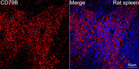 CD79B Rabbit Monoclonal Antibody - Image 6