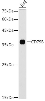 CD79B Rabbit Polyclonal Antibody
