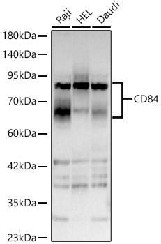 CD84 Rabbit Polyclonal Antibody