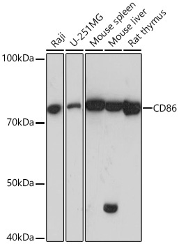 CD86 Rabbit Monoclonal Antibody
