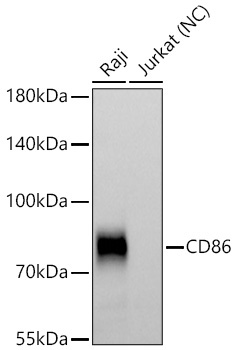 CD86 Rabbit Polyclonal Antibody
