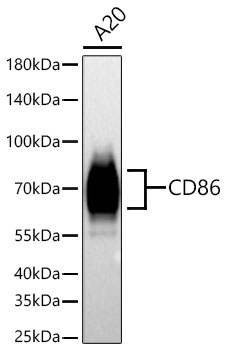 CD86 Rabbit Polyclonal Antibody