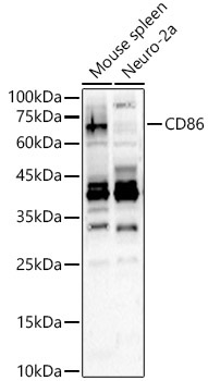 CD86 Rabbit Polyclonal Antibody