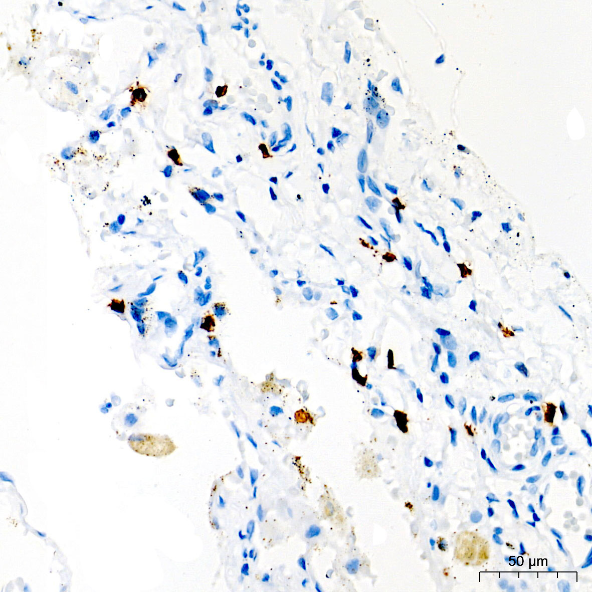 CD8A Rabbit Monoclonal Antibody