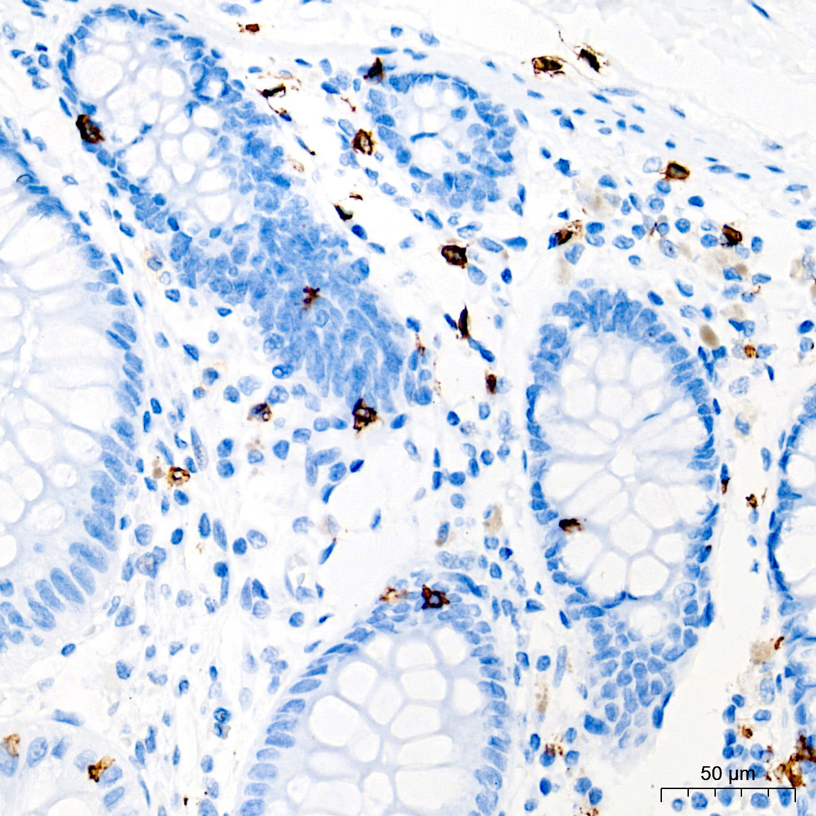 CD8A Rabbit Monoclonal Antibody - Image 2