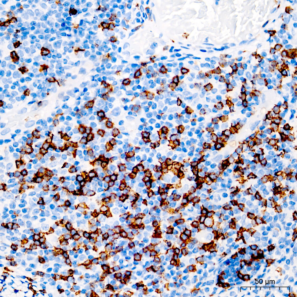 CD8A Rabbit Monoclonal Antibody - Image 3
