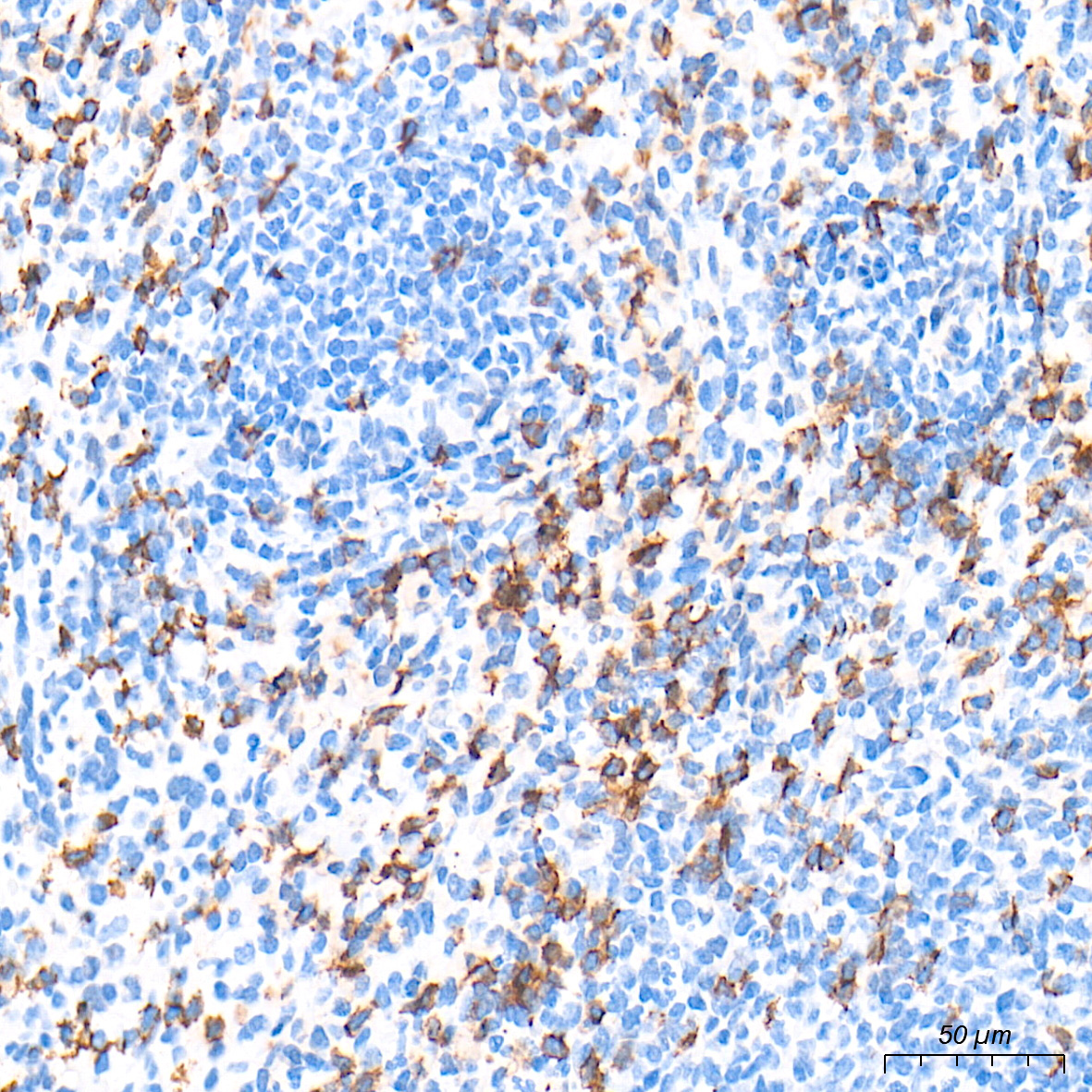 CD8A Rabbit Monoclonal Antibody - Image 4