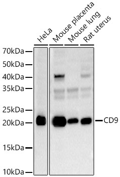 CD9 Rabbit Polyclonal Antibody