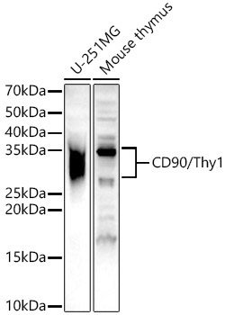 CD90/Thy1 Rabbit Polyclonal Antibody