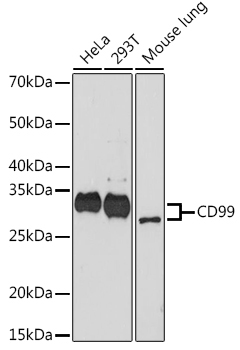 CD99 Rabbit Monoclonal Antibody