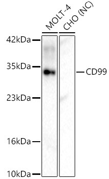 CD99 Rabbit Polyclonal Antibody