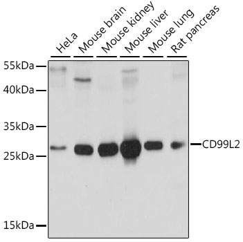 CD99L2 Rabbit Polyclonal Antibody