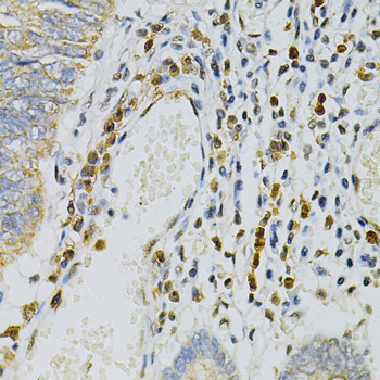 CDA Rabbit Polyclonal Antibody - Image 4
