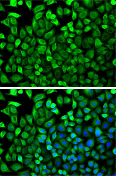 CDA Rabbit Polyclonal Antibody - Image 5