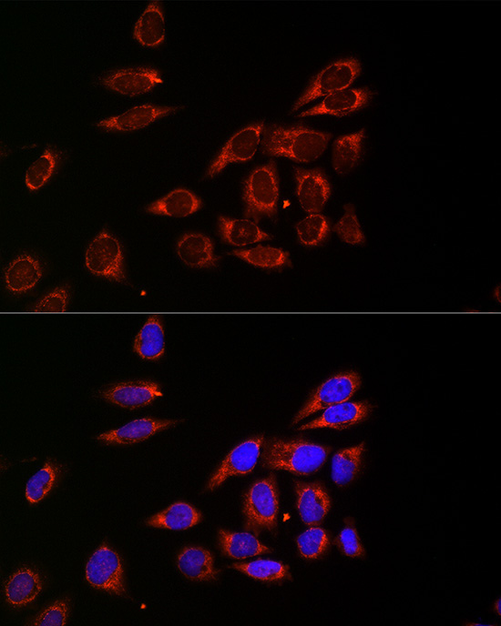CDA Rabbit Polyclonal Antibody - Image 2
