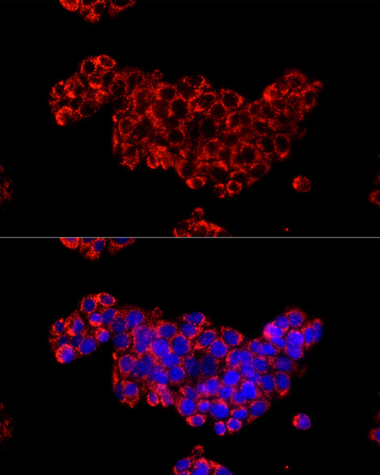 CDA Rabbit Polyclonal Antibody - Image 3