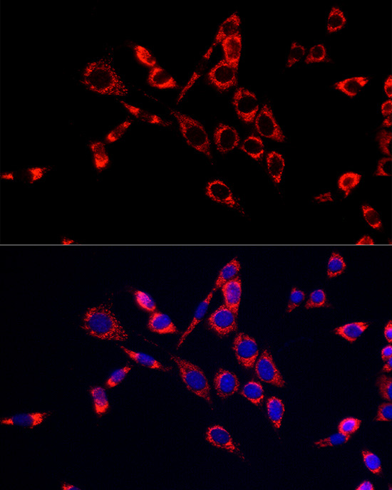 CDA Rabbit Polyclonal Antibody - Image 4