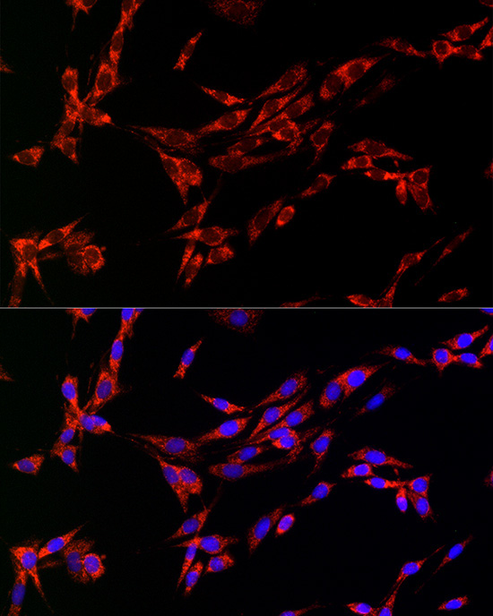 CDA Rabbit Polyclonal Antibody - Image 5