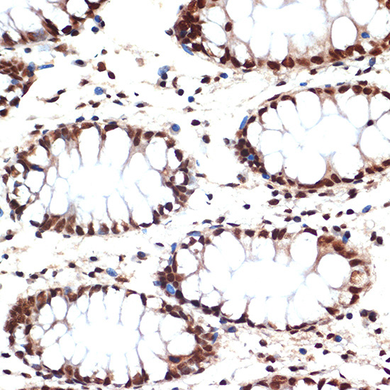 CDC16 Rabbit Monoclonal Antibody - Image 2