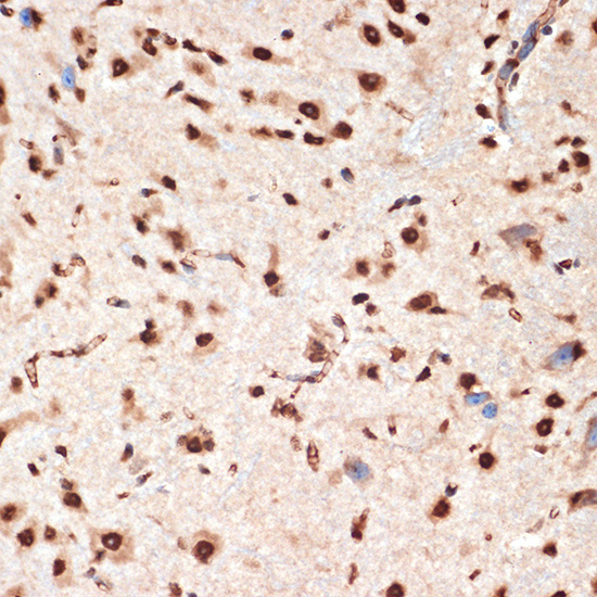 CDC16 Rabbit Monoclonal Antibody - Image 3