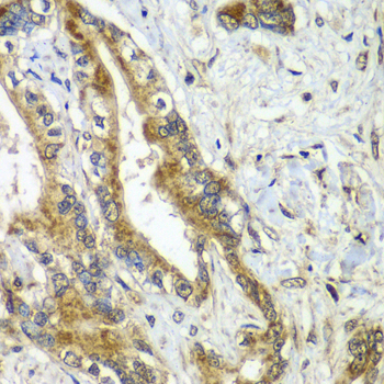 CDC16 Rabbit Polyclonal Antibody - Image 2